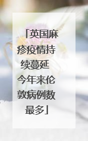 英国麻疹疫情持续蔓延 今年来伦敦病例数最多